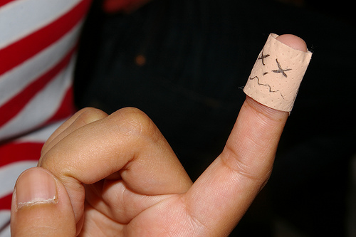 plaster finger photo